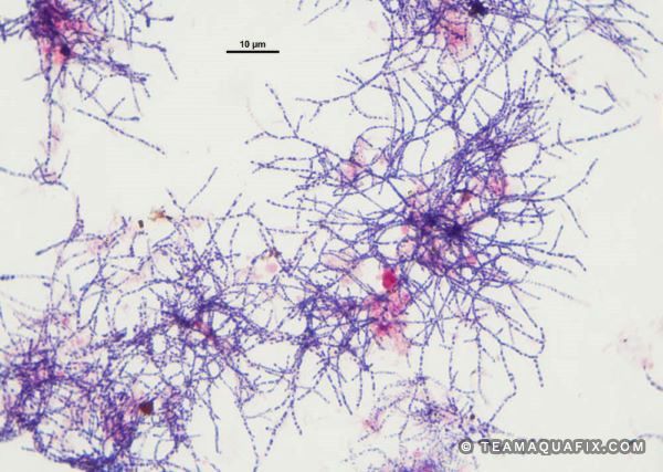 https://teamaquafix.com/wp-content/uploads/1000x-gram-stain-Nocardioform.jpg?v=1675093351