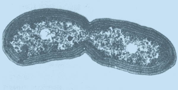 Restore Nitrification_Ammonia Removal