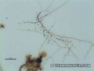nocardia in wastewater