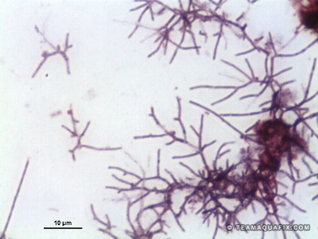 Nocardia Gram stained