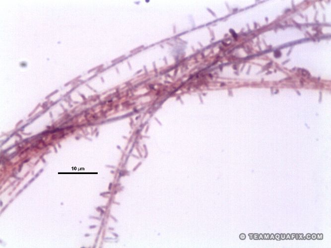 Type 1851 under Gram Stain