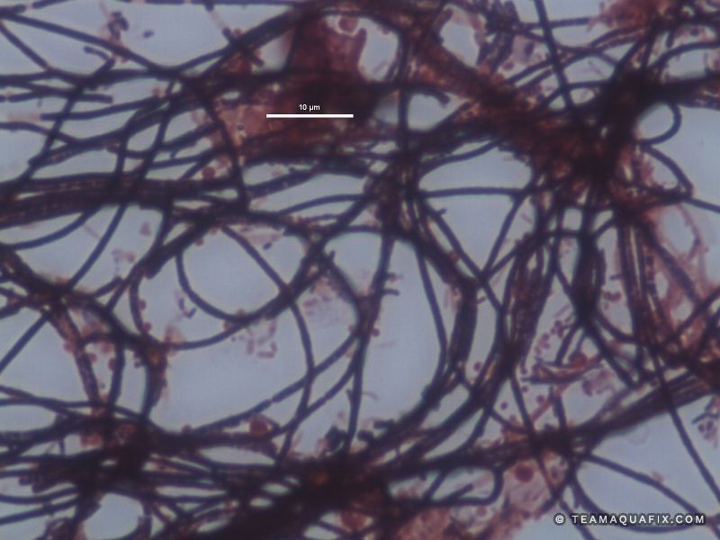 microthrix-aerobic-gram