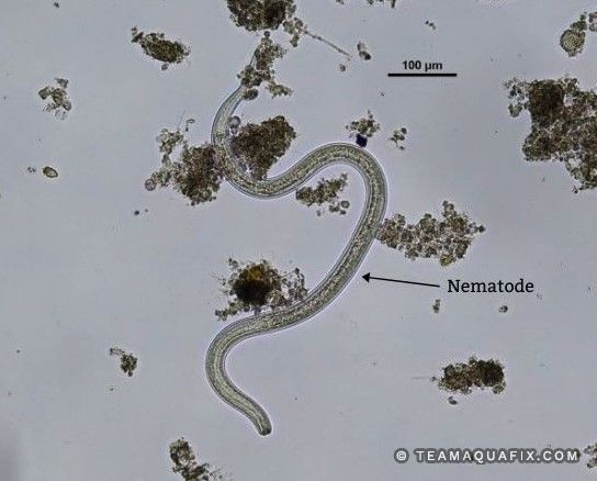 Photograph of a nematode (under microscope; ×100) indicating the three