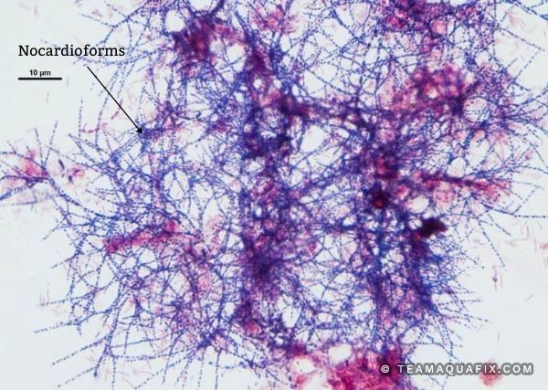 Nocardioforms & Nocardia Like Organisms