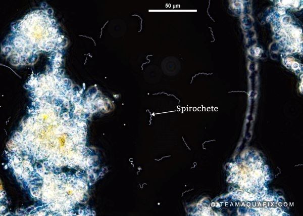 A Rotifer is a metazoan organism found in wastewater plants