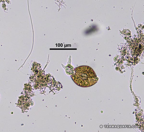amoeba under microscope 100x labeled